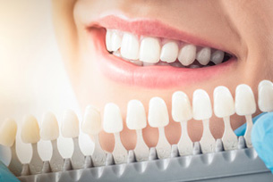 Ästhetische Zahnbehandlungen 